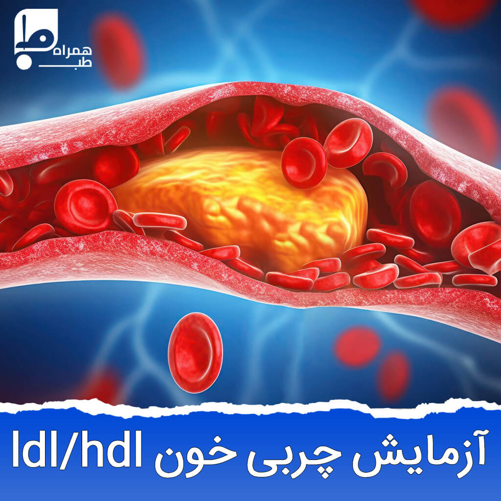 آزمایش چربی خون ldl / hdl