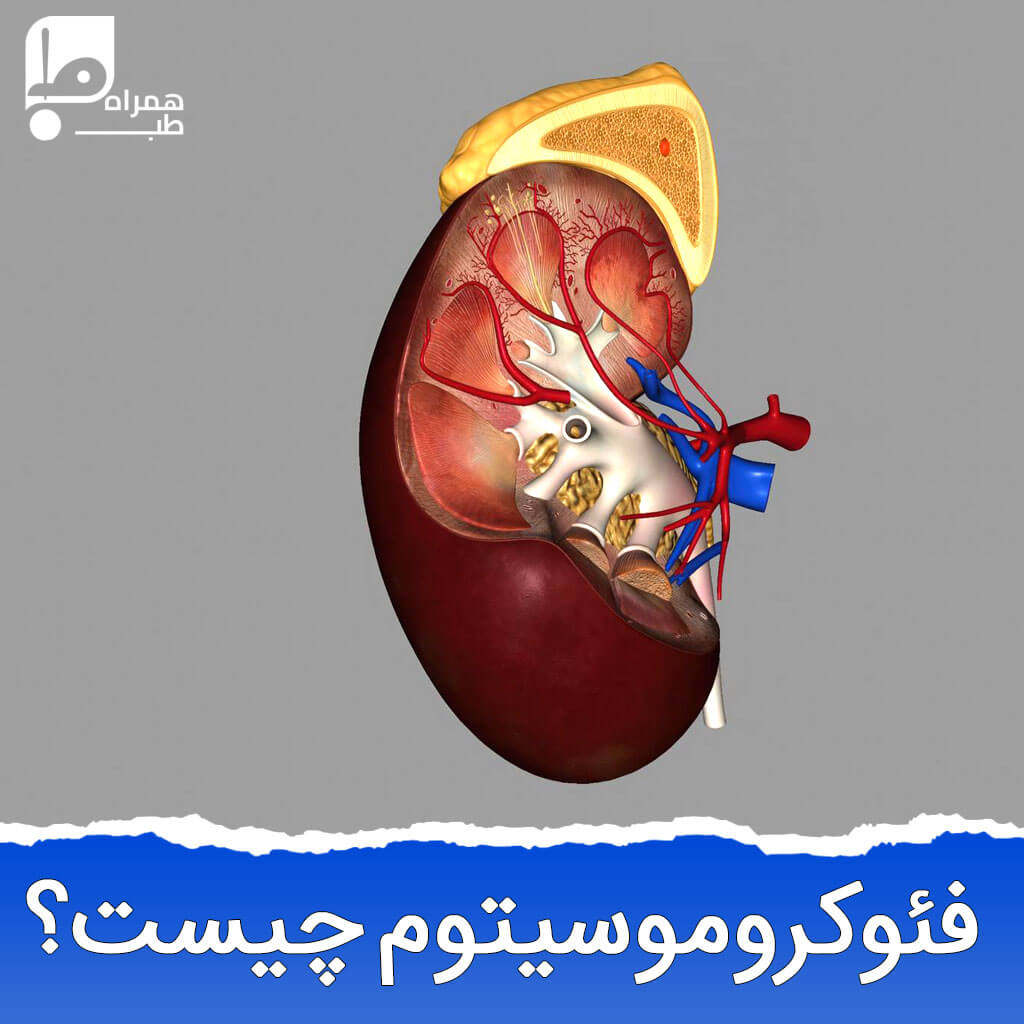 فئوکروموسیتوم