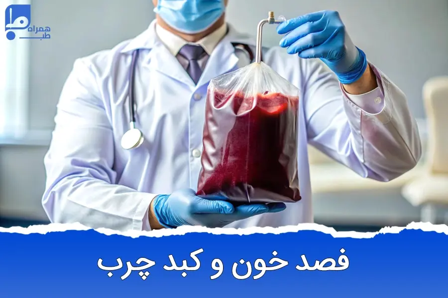 فصد خون برای کبد چرب