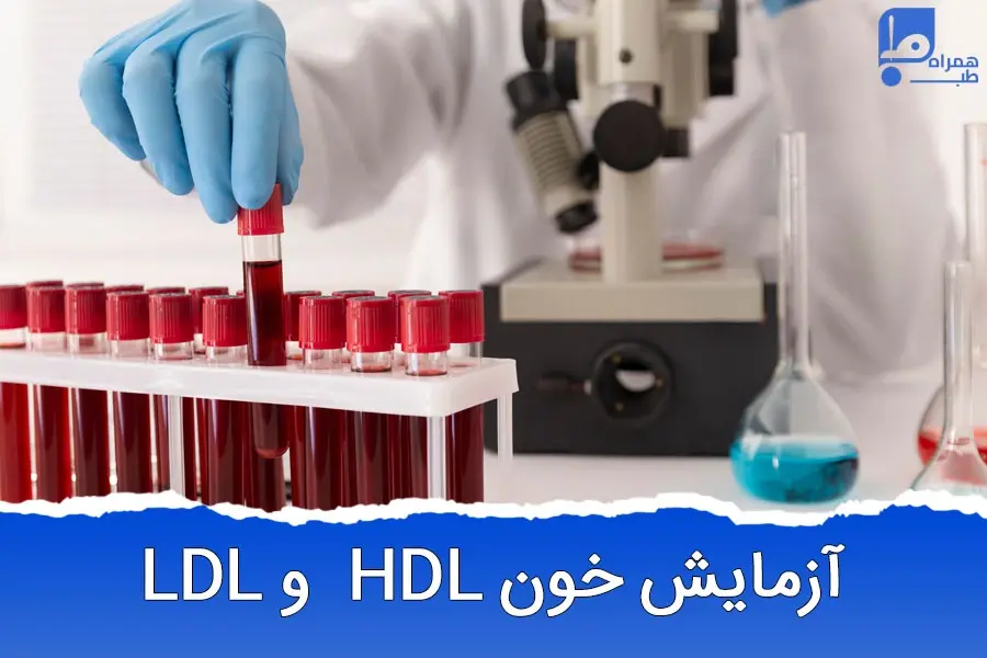 آزمایش چربی خون ldl / hdl