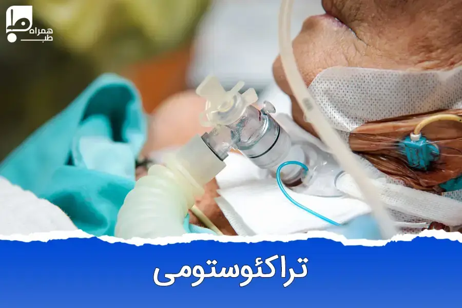 تراکئوستومی: جراحی نجات‌بخش یا خطری پنهان برای زندگی؟