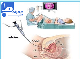 تعویض سوند ادرار در منزل