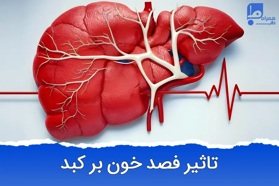 فصد خون برای کبد چرب