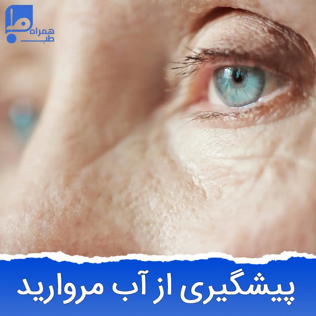 آب مروارید 