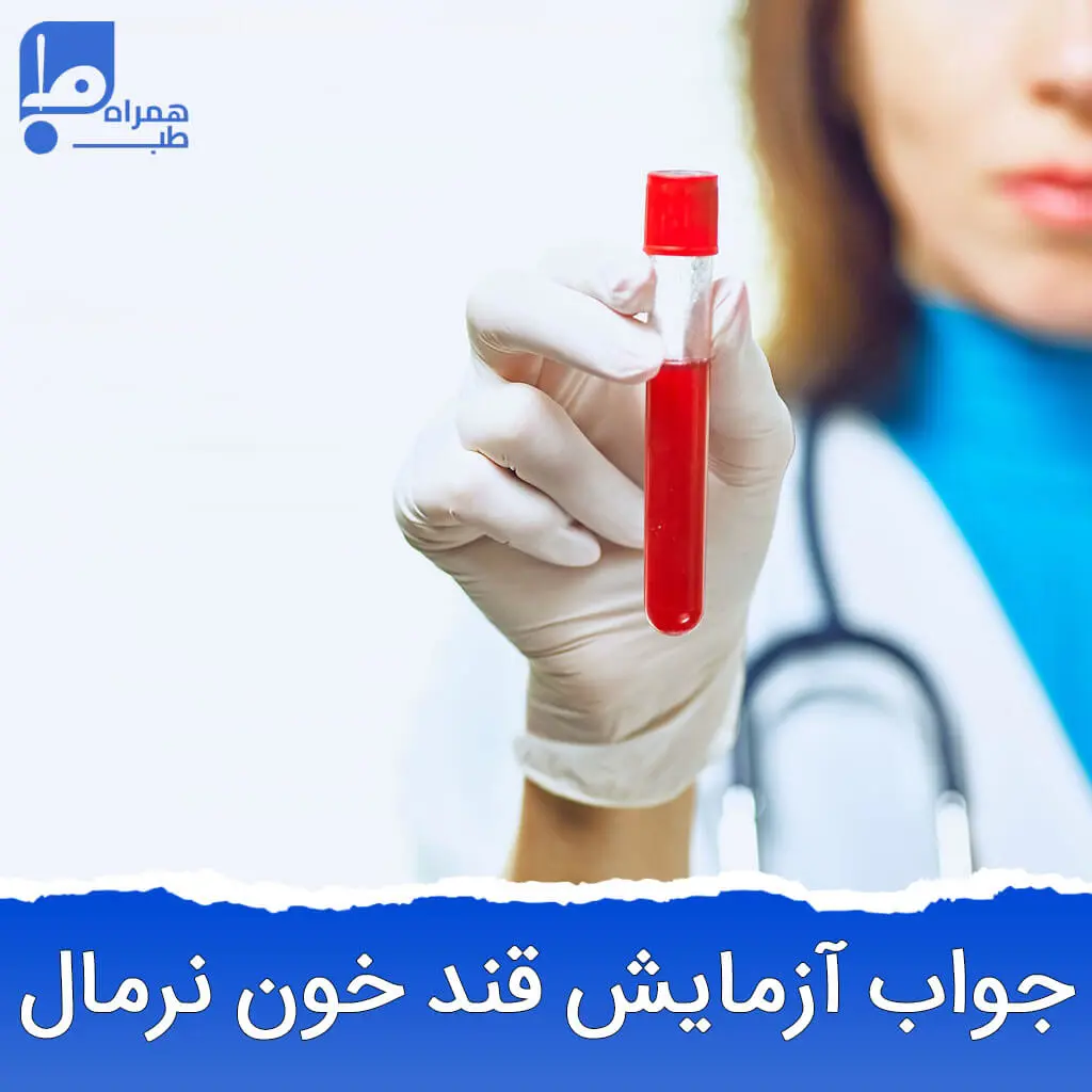 جواب آزمایش قند خون نرمال 