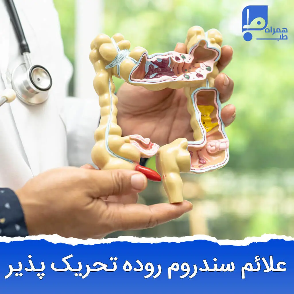 علائم سندروم روده تحریک پذیر 