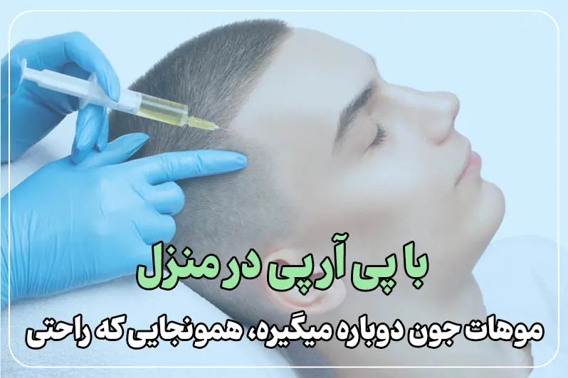 پی آر پی مو در منزل