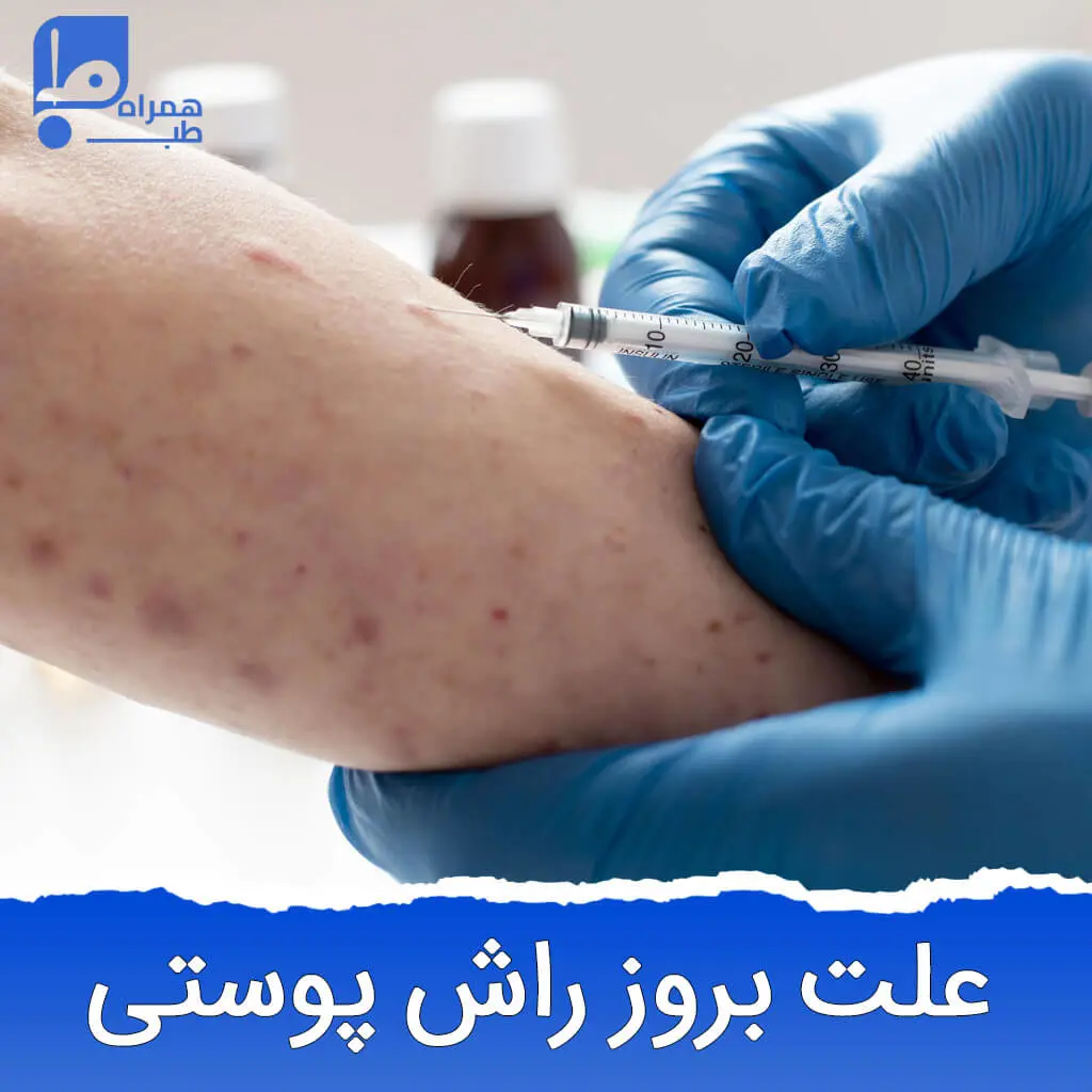علت بروز راش پوستی 