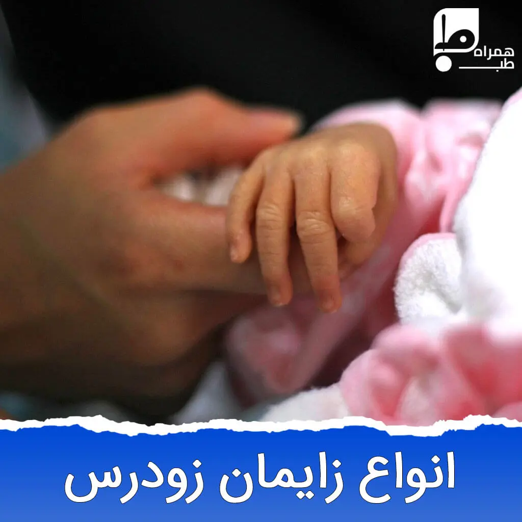 انواع زایمان زودرس