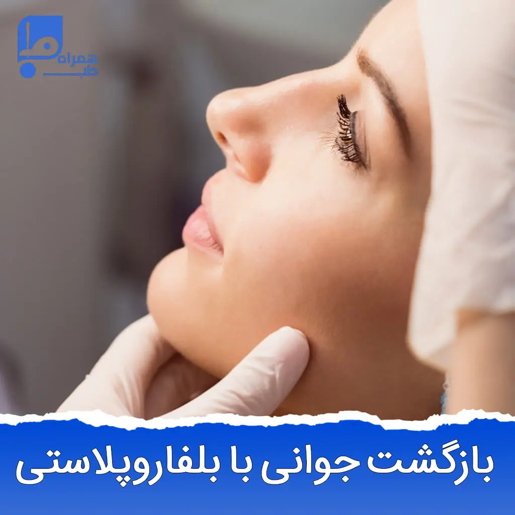 بلفاروپلاستی 