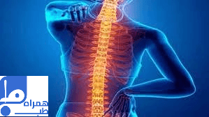 روماتیسم ستون فقرات 