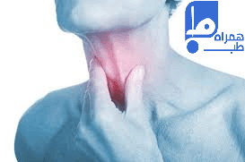 اختلال بلع 