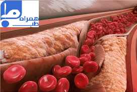 چربی خون بالا 