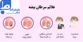 سرطان بیضه