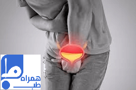 اسپاسم مثانه در مردان و زنان