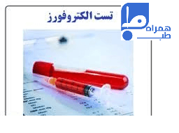 آزمایش الکتروفورز 