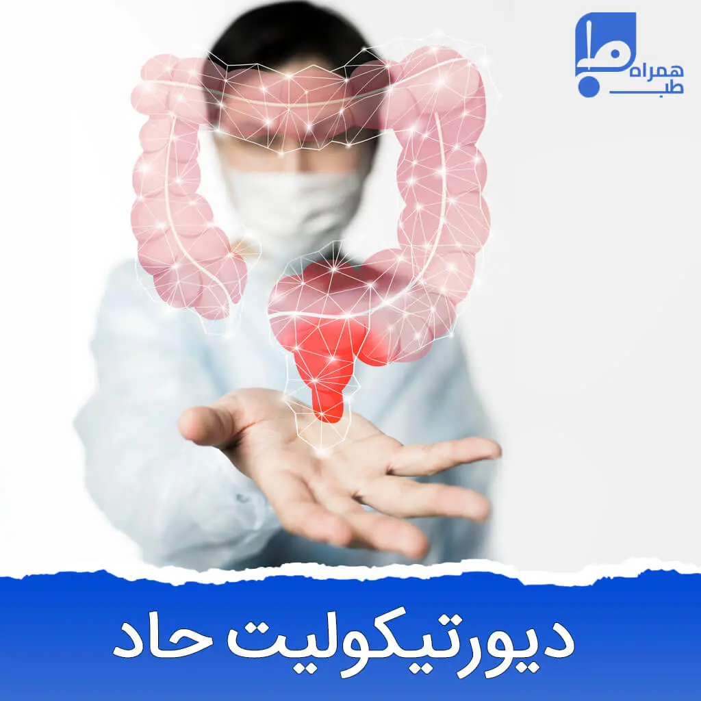دیورتیکولیت حاد 