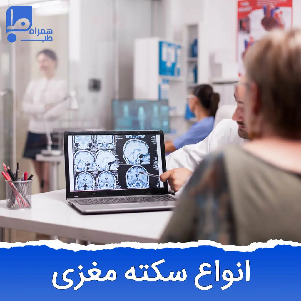 سکته مغزی 
