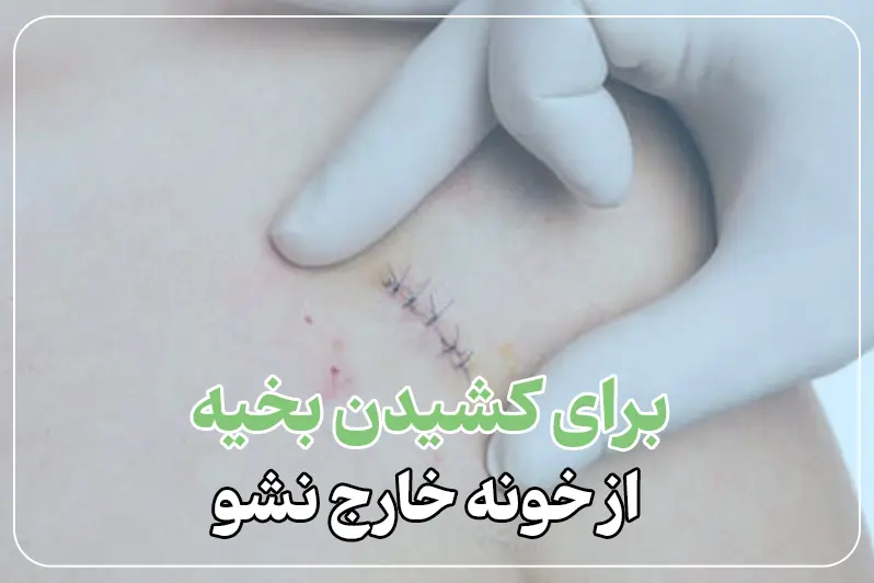 کشیدن بخیه در منزل