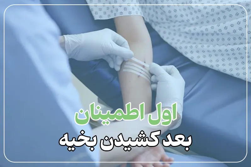 کشیدن بخیه در خانه