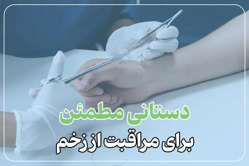 کشیدن بخیه در خونه