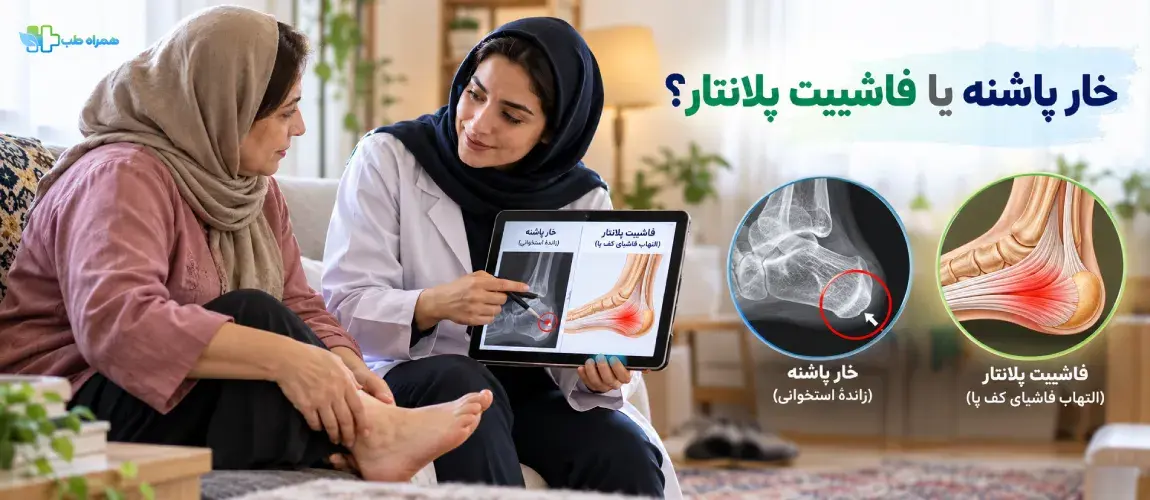 تفاوت خار پاشنه با التهاب فاشیای کف پا